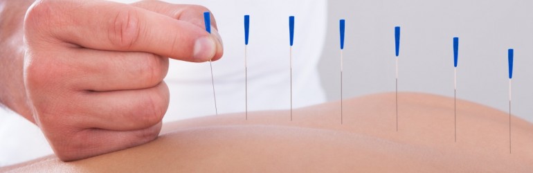 Mystic Mix Wellness Tip: Benefits of Acupuncture